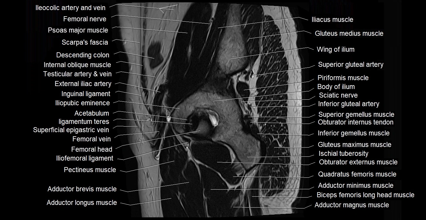 male pelvis sagittal cross sectional anatomy 3T mri image 5.webp